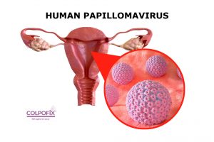 Wirus HPV o co tyle krzyku